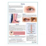 Ячмень медицинский плакат А1/A2