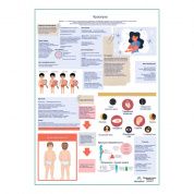 Краснуха, медицинский плакат А1+/A2+