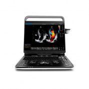 УЗИ сканер SonoTouch 60 Chison, Китай