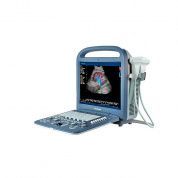 Ультразвуковой сканер S2 SonoScape, Китай