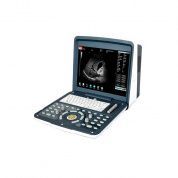 Переносной УЗИ сканер AcuVista RS880d Россия, Литва