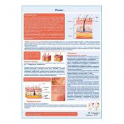 Рожа медицинский плакат А1/A2