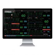 Центральная станция к прикроватным мониторам Storm, Dixion 