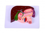 Анатомическая модель поджелудочной железы, двенадцатиперстной кишки и селезенки