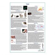 Чума, медицинский плакат А1+/А2+