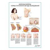 Молочные железы, мастопатия, самообследование, плакат глянцевый А1+/А2+