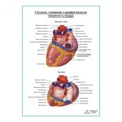 Сердце. Строение, основание и диафрагмальная поверхность плакат глянцевый А1+/А2+