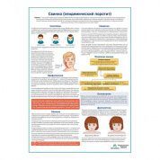 Свинка (эпидемический паротит) медицинский плакат А1/A2
