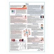 Корь медицинский плакат А1+/A2+