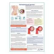 Бактериальный вагиноз медицинский плакат А1/A2