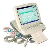 Фетальный монитор Sonicaid TEAM Duo с модулем печати и анализа IP TREND, Великобритания