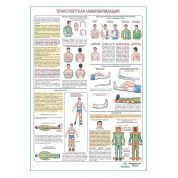 Транспортная иммобилизация, плакат глянцевый А1+/А2+