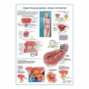 Предстательная железа. Норма и патология, плакат глянцевый А1/А2