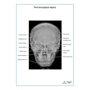 Рентгенография черепа плакат глянцевый  А1/А2