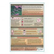 Скарлатина медицинский плакат А1+/A2+