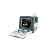 Цифровой УЗИ сканер АсuVista RS880f Россия, Литва