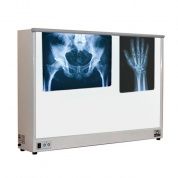 НС2-02-&amp;amp;amp;quot;ПОНИ&amp;amp;amp;quot; Негатоскоп двухкадровый, экран 430х700 мм