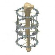 Комплект деталей аппарата Илизарова для взрослых, Россия