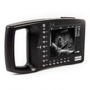 Портативный УЗИ-сканер AcuVista RS880b, Китай