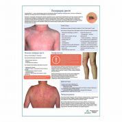 Лихорадка Денге медицинский плакат А1/A2