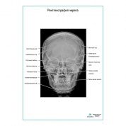 Рентгенография черепа плакат глянцевый  А1/А2