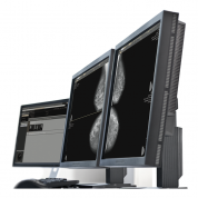 AI-платформа для анализа маммограмм ТриоДМ-МТ