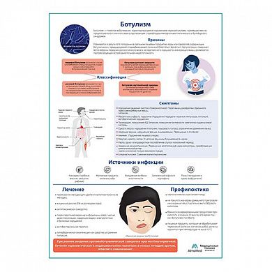Ботулизм медицинский плакат А1/A2