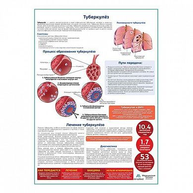 Туберкулёз медицинский плакат А1/A2