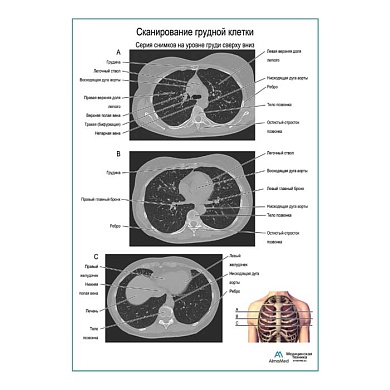 Сканирование грудной клетки плакат глянцевый  А1/А2