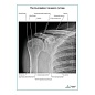 Рентгенография плечевого сустава плакат глянцевый  А1/А2