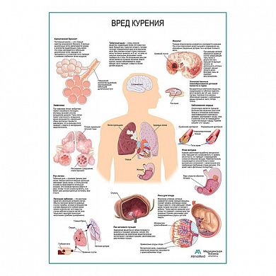 Вред курения плакат глянцевый А1/А2