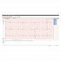 Электрокардиограф Поли-Спектр-8/Е