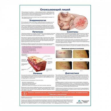 Опоясывающий лишай медицинский плакат А1/A2