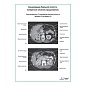 Сканирование брюшной полости: поперечное сечение (продолжение) плакат глянцевый А1/А2