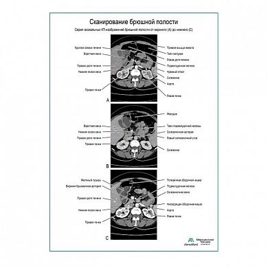 Сканирование брюшной полости плакат глянцевый  А1/А2