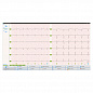 Электрокардиограф Поли-Спектр-8/EX