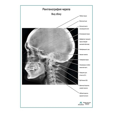 Рентгенография черепа. Вид сбоку плакат глянцевый А1/А2