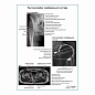 Рентгенография тазобедренного сустава плакат глянцевый А1/А2
