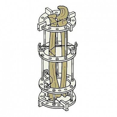 Комплект деталей аппарата Илизарова для плеча и предплечья, Россия