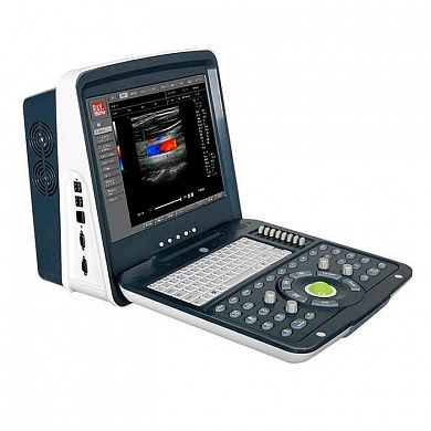 Портативный УЗИ сканер с цветным допплером AcuVista RS880i Россия, Литва
