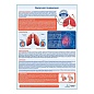 Вирусная пневмония медицинский плакат А1/A2