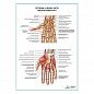 Артерии и нервы кисти, ладонная поверхность плакат глянцевый А1+/А2+