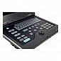 Портативный УЗИ сканер AcuVista RS880c Россия, Литва