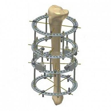 Комплект деталей аппарата Илизарова для таза, Россия