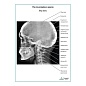 Рентгенография черепа. Вид сбоку плакат глянцевый А1/А2