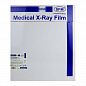 35 х 43 см (100 листов) - Синечувствительная Пленка медицинская для рентгенографии SFM общего назначения X-Ray BF, (Германия)