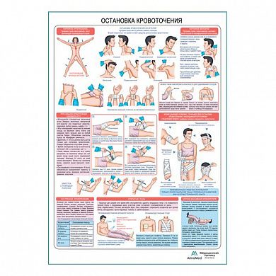 Остановка кровотечения, плакат глянцевый А1+/А2+