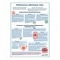 Инфекционные заболевания горла медицинский плакат А1/A2