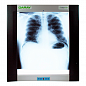 Daray DX4101LED Single Panel X-Ray Film Viewer - негатоскоп