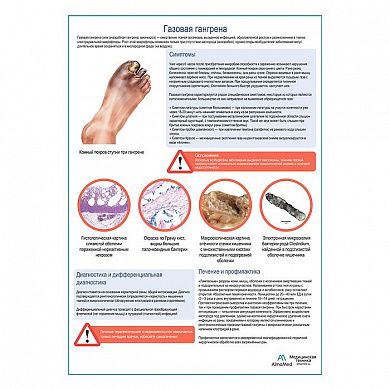 Газовая гангрена медицинский плакат А1+/A2+